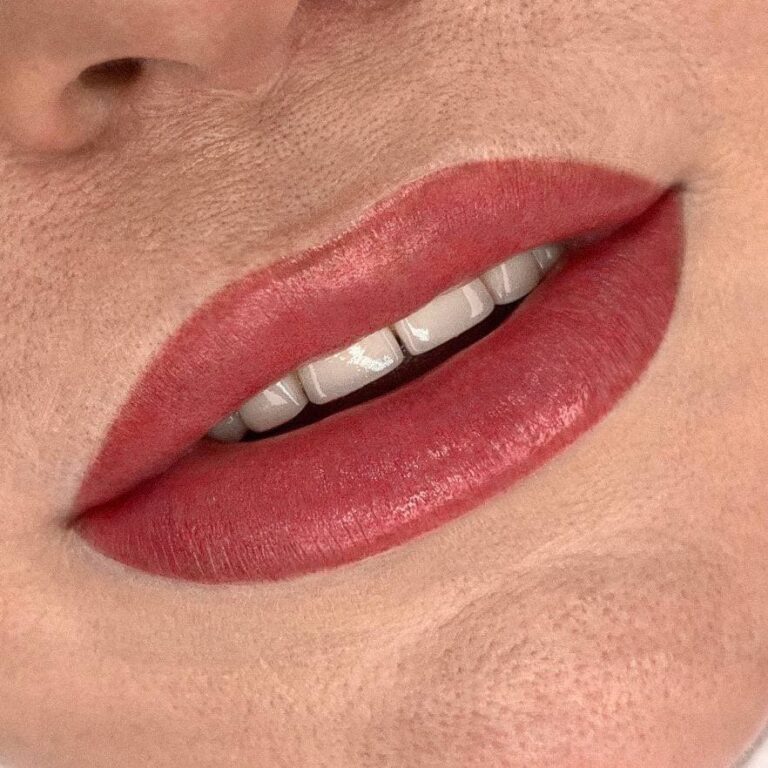 08